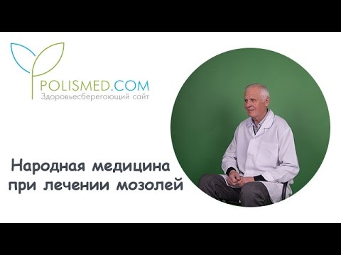 Видео: Народная медицина при лечении мозолей: уксус, перекись водорода, картофель, алоэ, лук, лимон