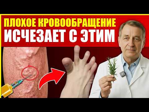 Видео: Вылечи варикоз на ногах с помощью этого секрета! — Улучшает кровообращение