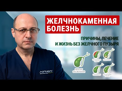 Видео: Желчнокаменная болезнь: причины, лечение и жизнь без желчного пузыря | доктор Юрий Гольдес