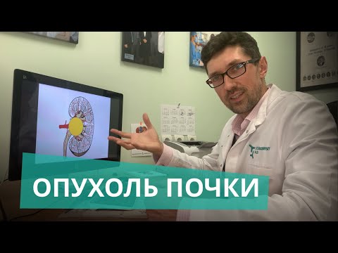 Видео: Опухоль почки: сохранить или удалить? С ишемией или без? Лапароскопически или открыто? А.Стаховский