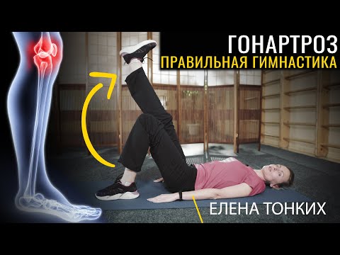 Видео: ᐈ Гонартроз. Правильная гимнастика для коленного сустава