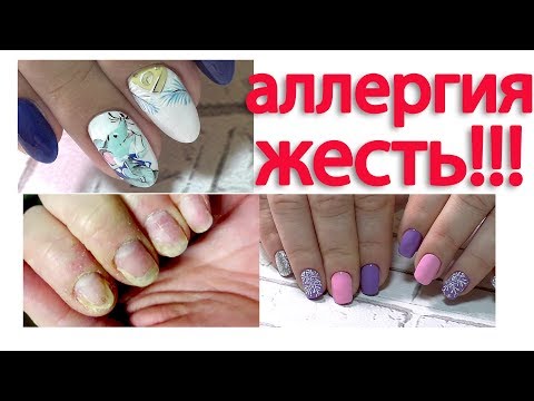 Видео: Дизайн ногтей МЫШОНОК. Аллергия на гель лак. Маникюр 2020