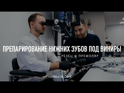 Видео: Препарирование нижних зубов под виниры. На примере резца и премоляра.