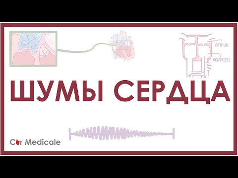 Видео: Шумы сердца: примеры (слушать в наушниках), причины и механизм, виды