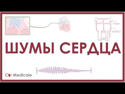 Видео: Шумы сердца: примеры (слушать в наушниках), причины и механизм, виды