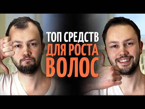 Видео: ТОП 5 средств для роста волос от врача дерматолога