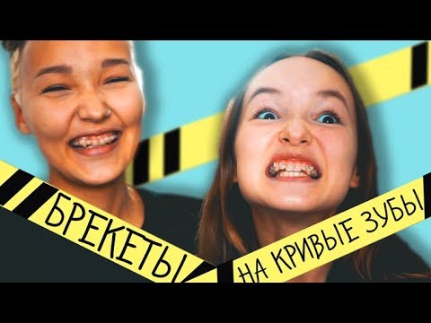 Видео: УСТАНОВКА БРЕКЕТОВ. КРИВЫЕ ЗУБЫ. МОЯ УЖАСНАЯ ИСТОРИЯ