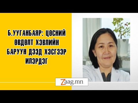 Видео: Б.Ууганбаяр: Цөсний өвдөлт хэвлийн баруун дээд хэсгээр илэрдэг
