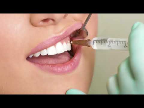 Видео: Что такое интралигаментарная электронная анестезия?