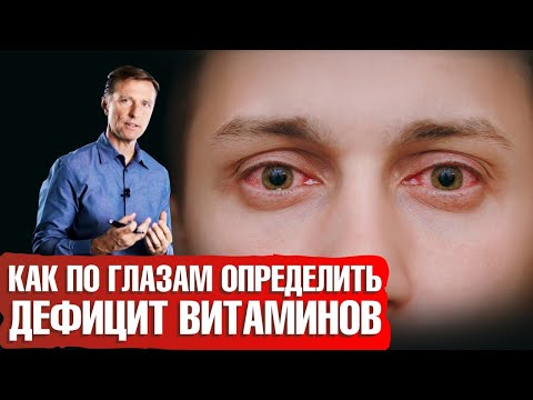 Видео: Красные глаза: как определить нехватку витаминов по глазам. Витамины для глаз.