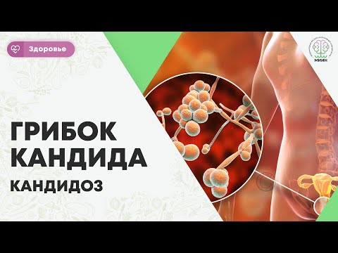Видео: ЗДОРОВЬЕ | Грибок Кандида. Кандидоз. Candida  откуда берется, факторы риска, диагностика.