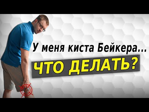Видео: Киста Бейкера. Упражнения.