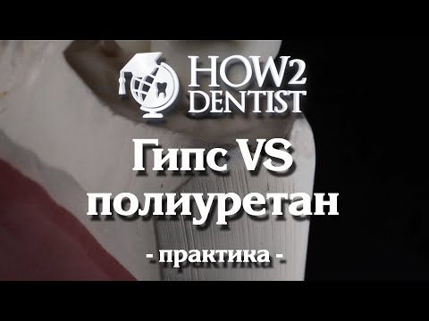 Видео: Как выбрать материал для модели? / How to Dentist