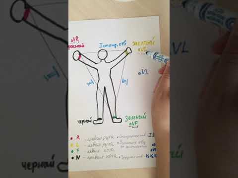 Видео: ЭКГ (Отведения)