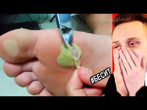 Видео: ВСЯ БОЛЬ В ОДНОМ ВИДЕО.. Попробуй не СКАЗАТЬ ФУ! РЕАКЦИЯ на САМОЕ НЕПРИЯТНОЕ ВИДЕО ТикТок Райли