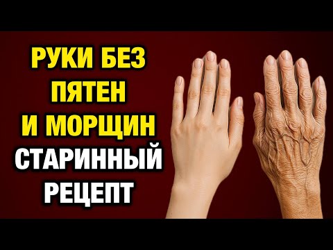 Видео: Руки моложе на 10 лет за неделю! Старинный рецепт, который всё ещё работает!