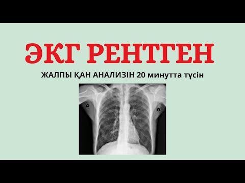 Видео: 🆘ЭКГ ОСЫНДАЙ ОҢАЙ МА?  🤯
