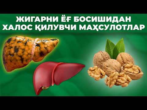 Видео: ЖИГАРНИ ЁГДАН БУТУНЛАЙ ТОЗАЛАЙДИГАН ТОП 10 ТА МАҲСУЛОТ