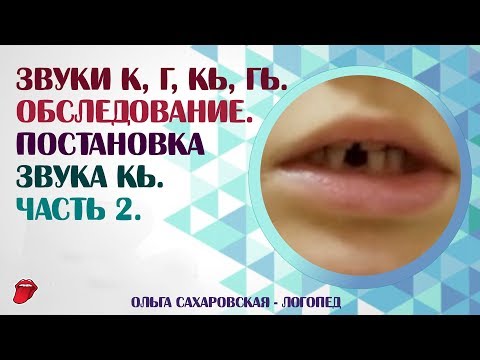 Видео: Звуки  К, Г, Кь, Гь. Постановка звука Кь механическим способом. Часть 2
