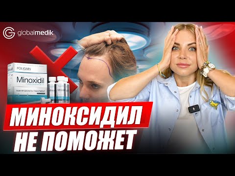 Видео: Пересадка волос в Турции - мифы и легенды | перестаньте себя накручивать