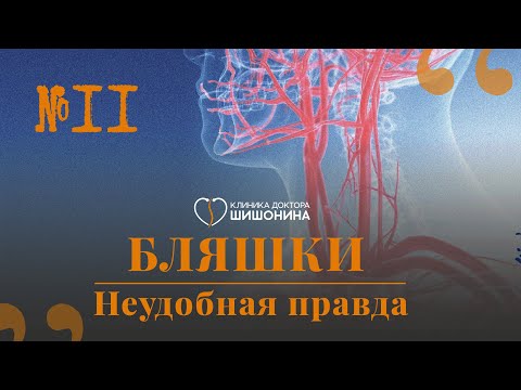 Видео: Бляшки и как с ними жить: рассказывает сосудистый хирург в новом выпуске «Хорошей медицины» 💊