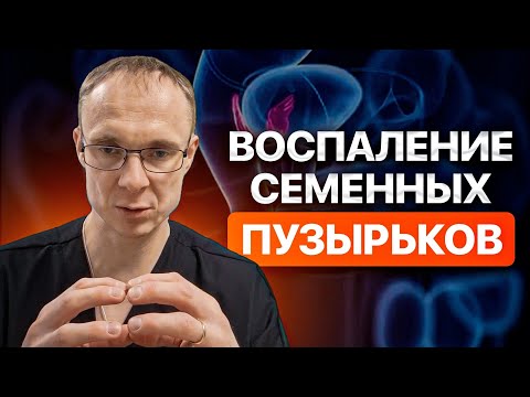 Видео: Воспаление семенных пузырьков. Везикулит. Врач уролог-андролог. Москва.