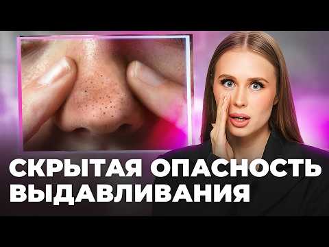 Видео: Привычка, которая испортит кожу навсегда! Реальные последствия выдавливания прыщей