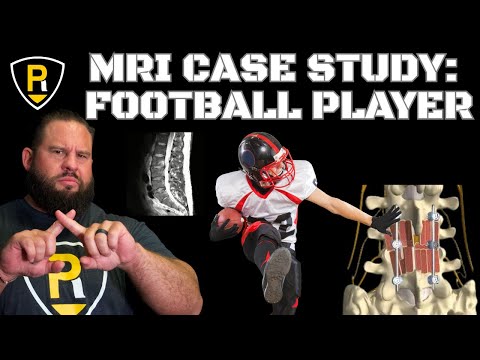 Видео: Исследование МРТ профессионального футболиста (сравнение за 2 месяца)