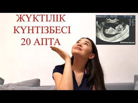 Видео: ЖҮКТІЛІК КҮНТІЗБЕСІ 20 АПТА//КАЛЕНДАРЬ БЕРЕМЕННОСТИ