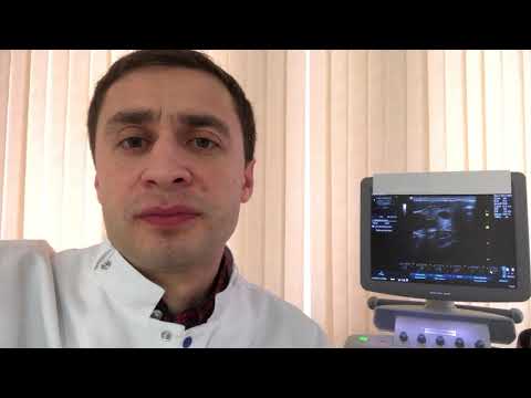 Видео: Узел или киста щитовидной железы? Различия и сходства.