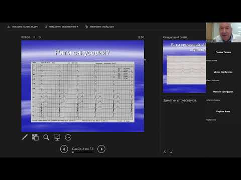 Видео: Оформлення ЕКГ-висновку