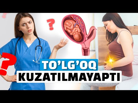 Видео: ТУҒРУҚ МУДДАТИ ЎТИБ КЕТТИ, ДАРД КЕЛМАЯПТИ. НИМА ҚИЛИШ КЕРАК?