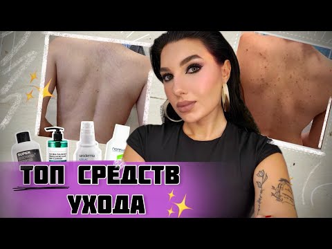 Видео: ВСЕ О ПРЫЩАХ НА СПИНЕ/ СОВЕТЫ КОСМЕТОЛОГА + РАБОЧИЙ УХОД