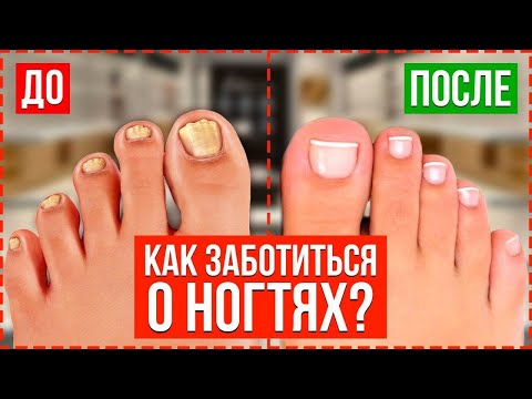 Видео: ПЕДИКЮР У ПОДОЛОГА = ЗДОРОВЬЕ ВАШИХ НОГТЕЙ. Узнай Подробную Информацию ПРЯМО СЕЙЧАС