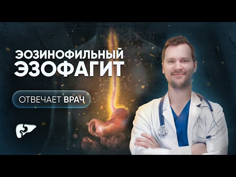 Видео: Аллергия пищевода - эозинофильный эзофагит: симптомы, диагностика, лечение