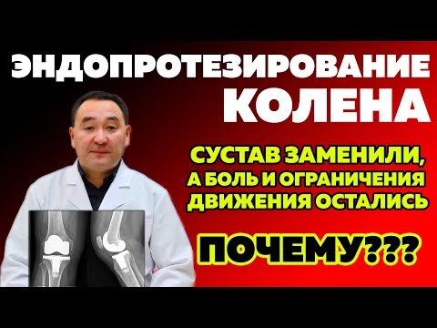 Видео: Замена коленного сустава