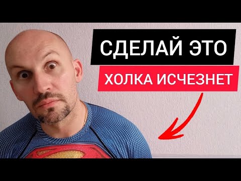Видео: Холка Сама Уйдёт. Делай это упражнение