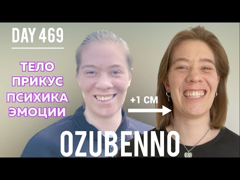 Видео: БЕЗ БРЕКЕТОВ день 469: Планас, череп, тело, психика, эмоции - связь с прикусом