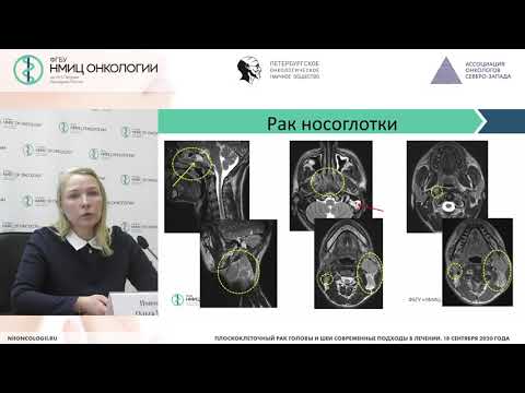 Видео: Роль МРТ  в первичной диагностике ОГШ