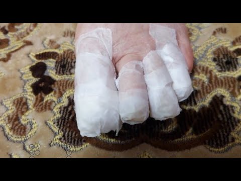 Видео: ДЕМЕНЦИЯ :.срезаем ногти на ногах..могло быть и хуже..как жить с тем-у которого #деменция #мама #39s