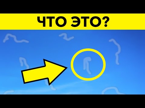 Видео: Если вы заметили эти частицы у себя в глазах, то должны это знать