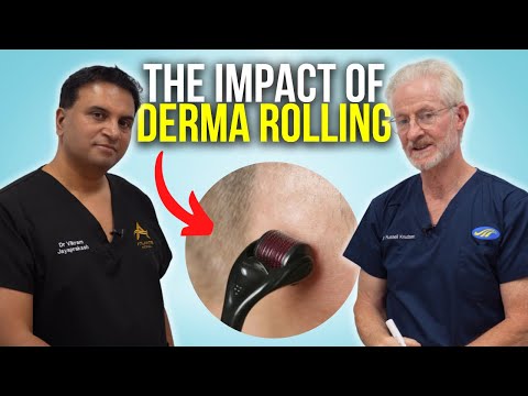 Видео: Дермароллинг: влияние на местную терапию | Шоу о выпадении волос