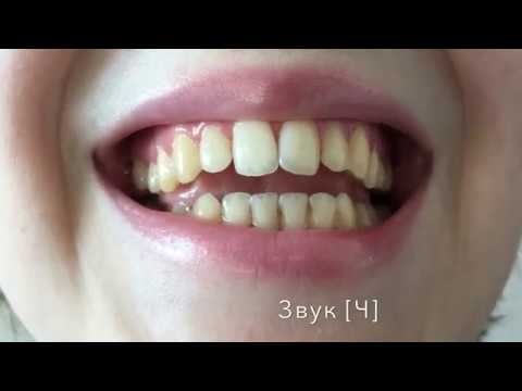 Видео: Дифференциация звуков Ч и Ть – видеоурок