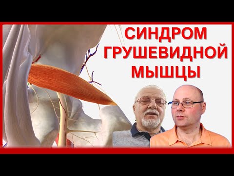 Видео: Синдром грушевидной мышцы: Диагностика, Лечение и отличие от грыжи диска