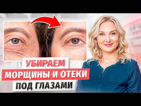 Видео: Уход за кожей вокруг глаз. Процедуры у КОСМЕТОЛОГА которые РЕАЛЬНО работают!