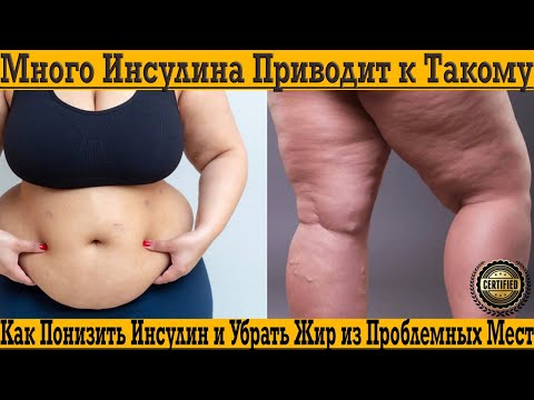 Видео: Много инсулина приводит к такому ужасу на теле!