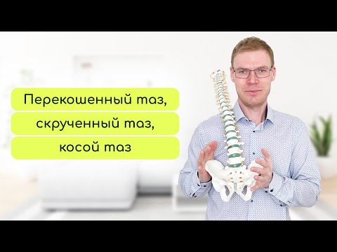 Видео: Косой, скрученный, перекошенный таз. Все это может быть причиной боли в спине или разной длины ног