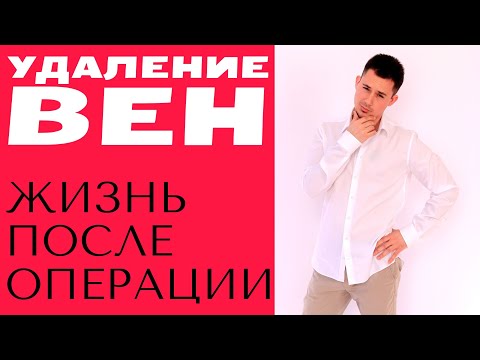 Видео: Удаление вен | Флебэктомия | Жизнь после удаления вен