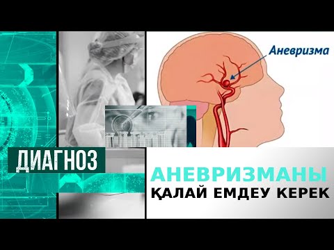 Видео: Аневризманы қалай емдеу керек | Диагноз