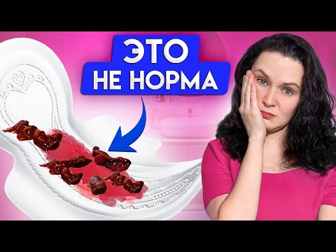 Видео: СГУСТКИ при менструации. Почему ЭТО происходит во время месячных?